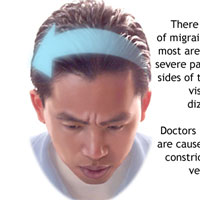 Common Migraine Symptoms - New Life Outlook | Migraine