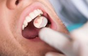 Dentist and Migraines
