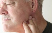 TMJ and Migraines
